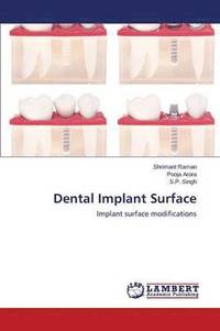 bokomslag Dental Implant Surface
