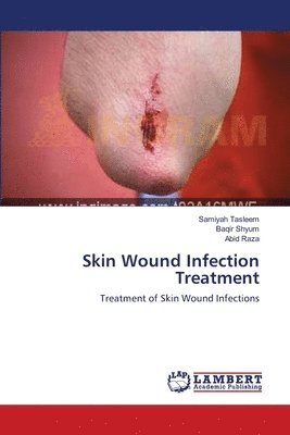 Skin Wound Infection Treatment 1