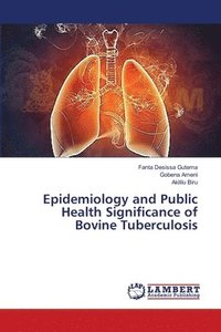 bokomslag Epidemiology and Public Health Significance of Bovine Tuberculosis