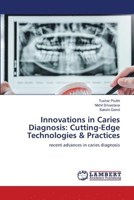 Tushar Pruthi, Nikhil Srivastava, Sakshi Gaind - Innovations in Caries Diagnosis, Häftad