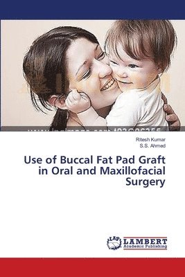 Use of Buccal Fat Pad Graft in Oral and Maxillofacial Surgery 1