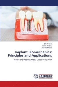 bokomslag Implant Biomechanics
