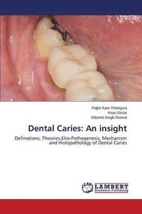 bokomslag Dental Caries