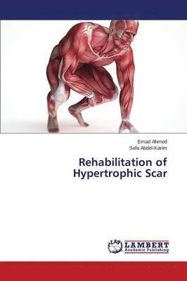 Rehabilitation of Hypertrophic Scar 1