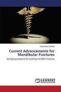 bokomslag Current Advancements for Mandibular Fractures