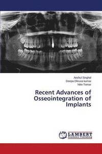 bokomslag Recent Advances of Osseointegration of Implants