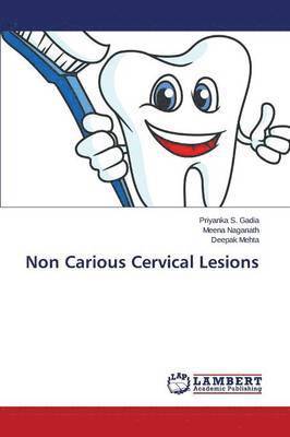 Non Carious Cervical Lesions 1