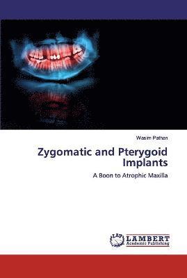 Zygomatic and Pterygoid Implants 1