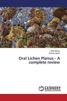 Mishra Nishi, Jayam Raviraj, Nishi Mishra, Raviraj Jayam - Oral Lichen Planus - A complete review, Häftad