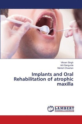 bokomslag Implants and Oral Rehabilitation of atrophic maxilla