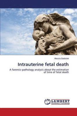 bokomslag Intrauterine fetal death