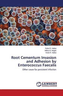 bokomslag Root Cementum Invasion and Adhesion by Enterococcus Faecalis