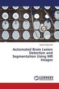 bokomslag Automated Brain Lesion Detection and Segmentation Using MR Images