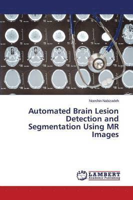 Automated Brain Lesion Detection and Segmentation Using MR Images 1