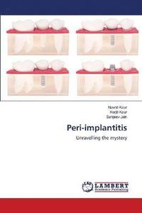 bokomslag Peri-implantitis