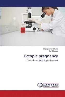 bokomslag Ectopic pregnancy