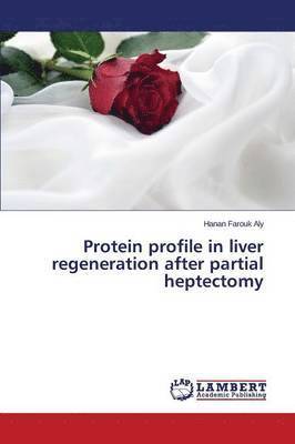 bokomslag Protein profile in liver regeneration after partial heptectomy