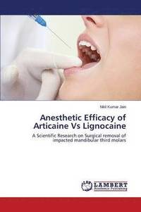 bokomslag Anesthetic Efficacy of Articaine Vs Lignocaine