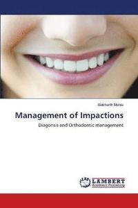 bokomslag Management of Impactions