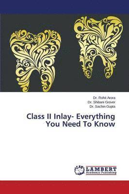 Class II Inlay- Everything You Need To Know 1