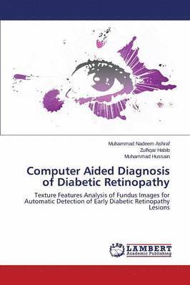 Computer Aided Diagnosis of Diabetic Retinopathy 1