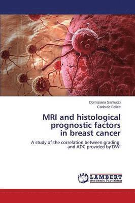 bokomslag MRI and histological prognostic factors in breast cancer