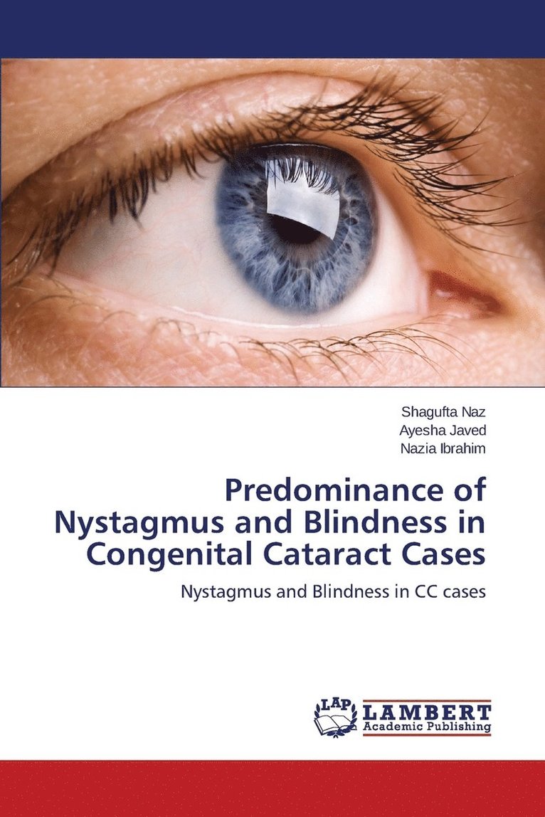 Predominance of Nystagmus and Blindness in Congenital Cataract Cases 1