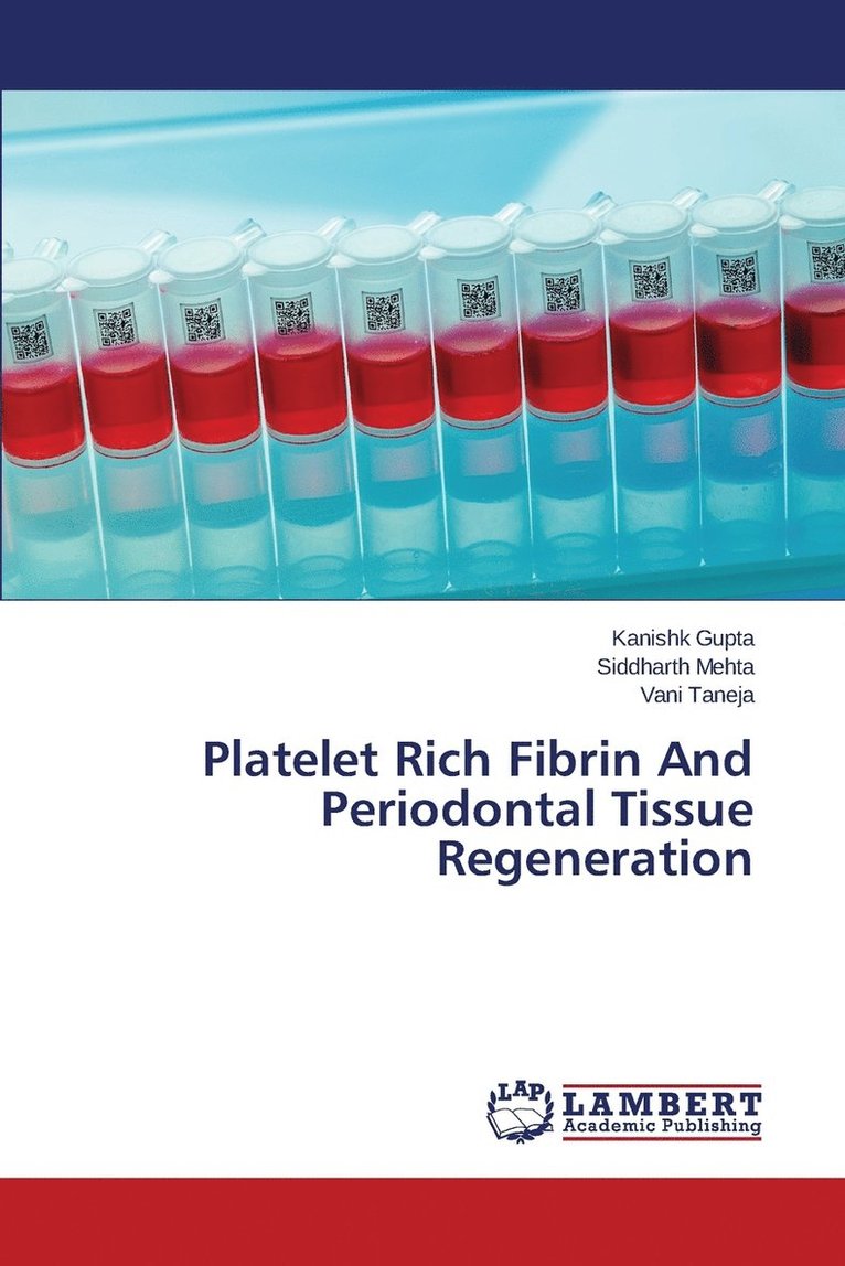 Platelet Rich Fibrin And Periodontal Tissue Regeneration 1