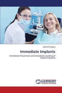 bokomslag Immediate Implants