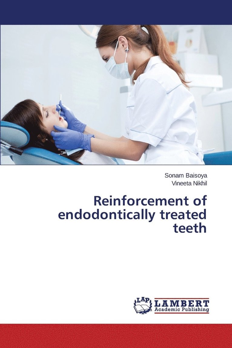 Reinforcement of endodontically treated teeth 1