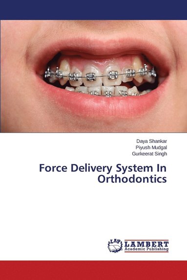 bokomslag Force Delivery System In Orthodontics