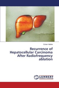 bokomslag Recurrence of Hepatocellular Carcinoma After Radiofrequency ablation