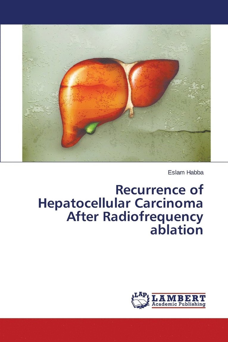 Recurrence of Hepatocellular Carcinoma After Radiofrequency ablation 1