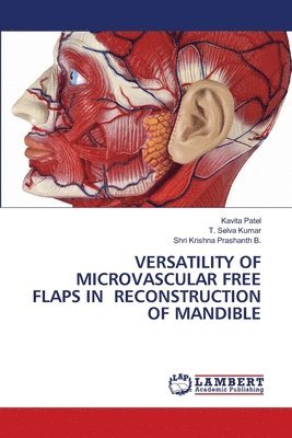 Kavita Patel, T Selva Kumar, Shri Krishna Prashanth B - Versatility of Microvascular Free Flaps in Reconstruction of Mandible, Häftad