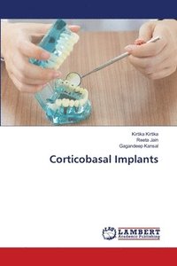 bokomslag Corticobasal Implants