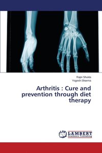 bokomslag Arthritis