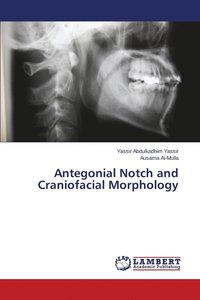 bokomslag Antegonial Notch and Craniofacial Morphology