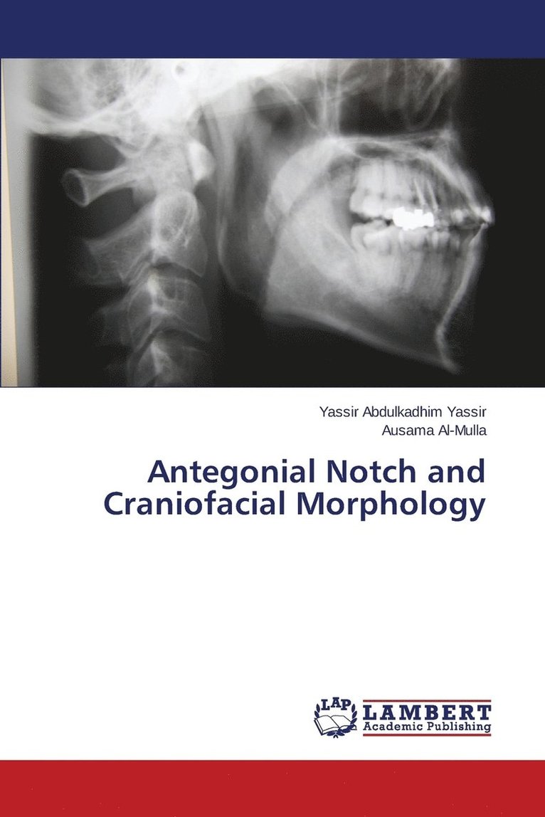 Antegonial Notch and Craniofacial Morphology 1
