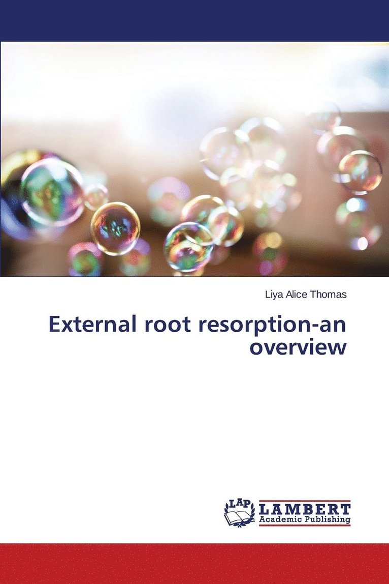 External root resorption-an overview 1