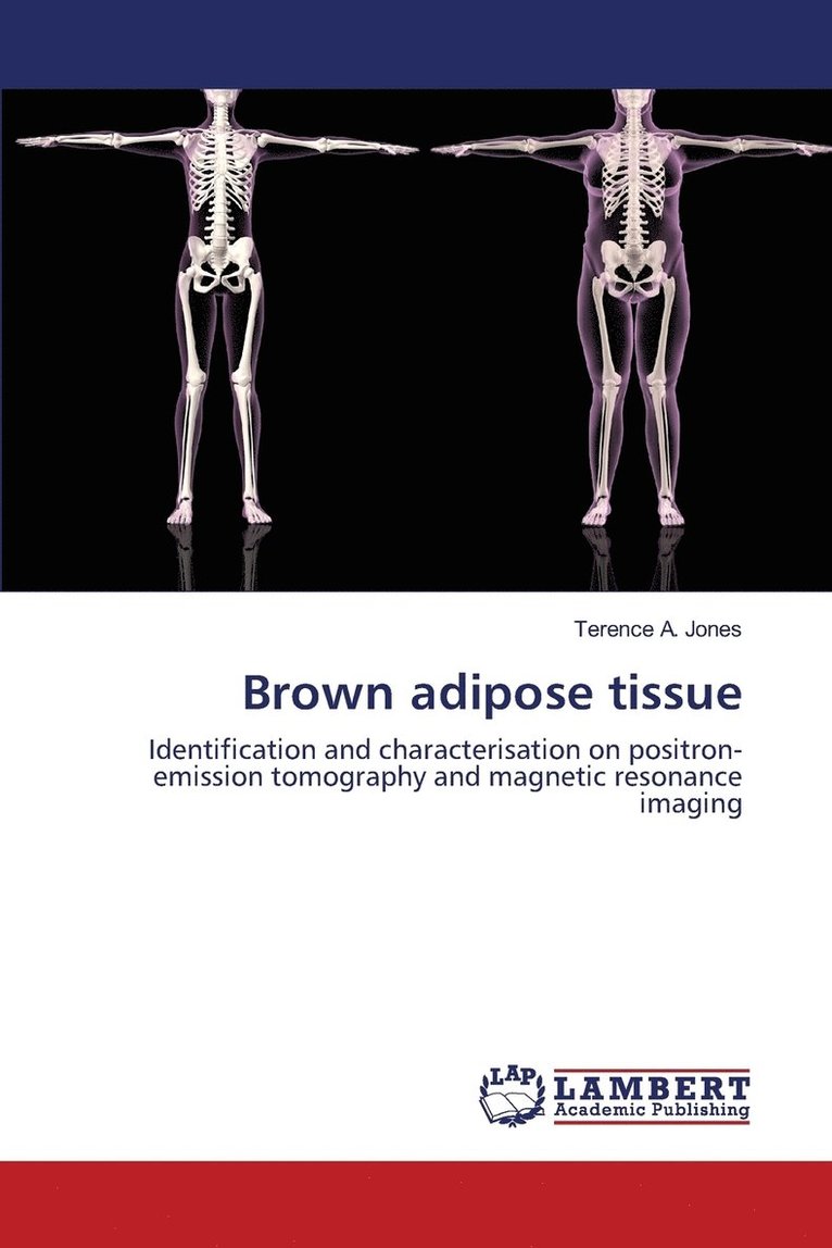 Brown adipose tissue 1