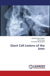 bokomslag Giant Cell Lesions of the Jaws