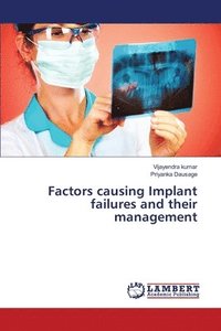 bokomslag Factors causing Implant failures and their management