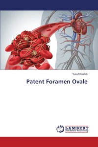 bokomslag Patent Foramen Ovale