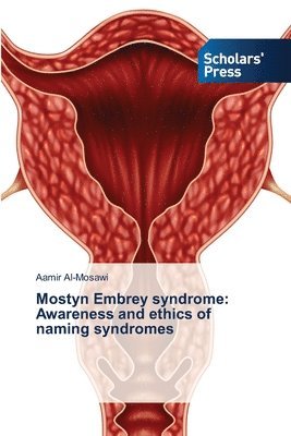 Mostyn Embrey syndrome 1