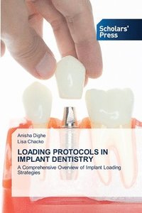bokomslag Loading Protocols in Implant Dentistry