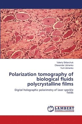Valeriy Skliarchuk, Olexander Ushenko, Yurii Ushenko - Polarization tomography of biological fluids polycrystalline films, Häftad
