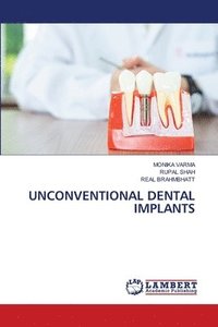 bokomslag Unconventional Dental Implants