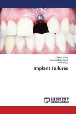 bokomslag Implant Failures