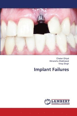 Implant Failures