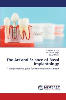 Manish Kumar, Gaurav Singh, Amit Gaur - Art and Science of Basal Implantology, Häftad